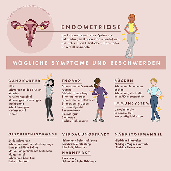 Endometriose 